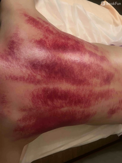 professional 刮沙/拔罐 - 健寧坊 - 按摩 in 香港島 | BookFun