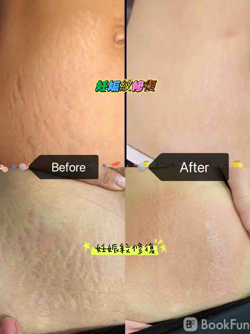 優質 九龍 美容 | 一繡傾城形象設計皮膚管理 - 專業服務 | BookFun