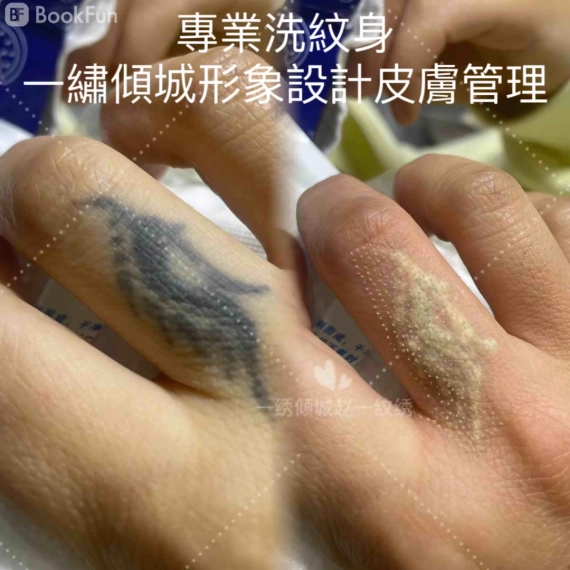 quality 洗紋身 - 一繡傾城形象設計皮膚管理 - 美容 in 九龍 | BookFun