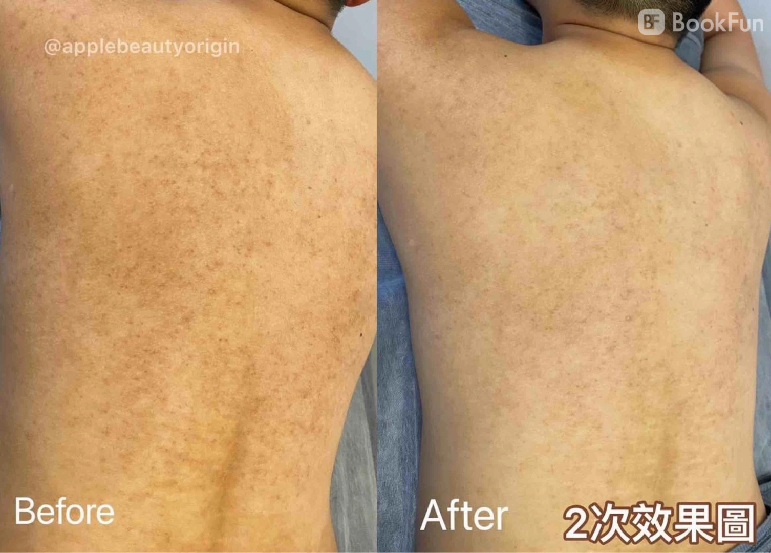Apple Beauty Origin