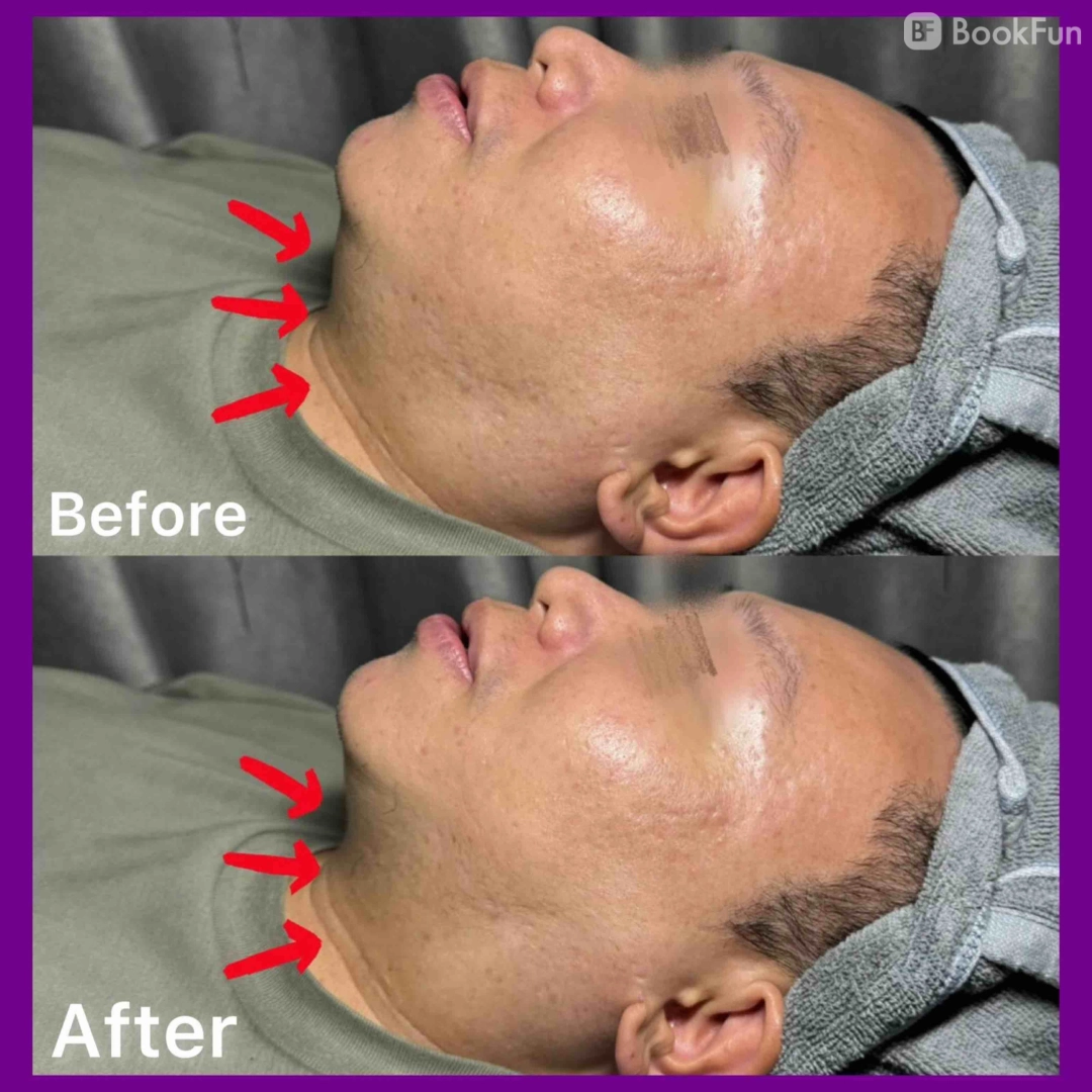 優質 九龍 美容 | Apple Beauty Origin - 專業服務 | BookFun