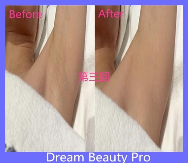 Dream Beauty Pro (旺角VIP店)